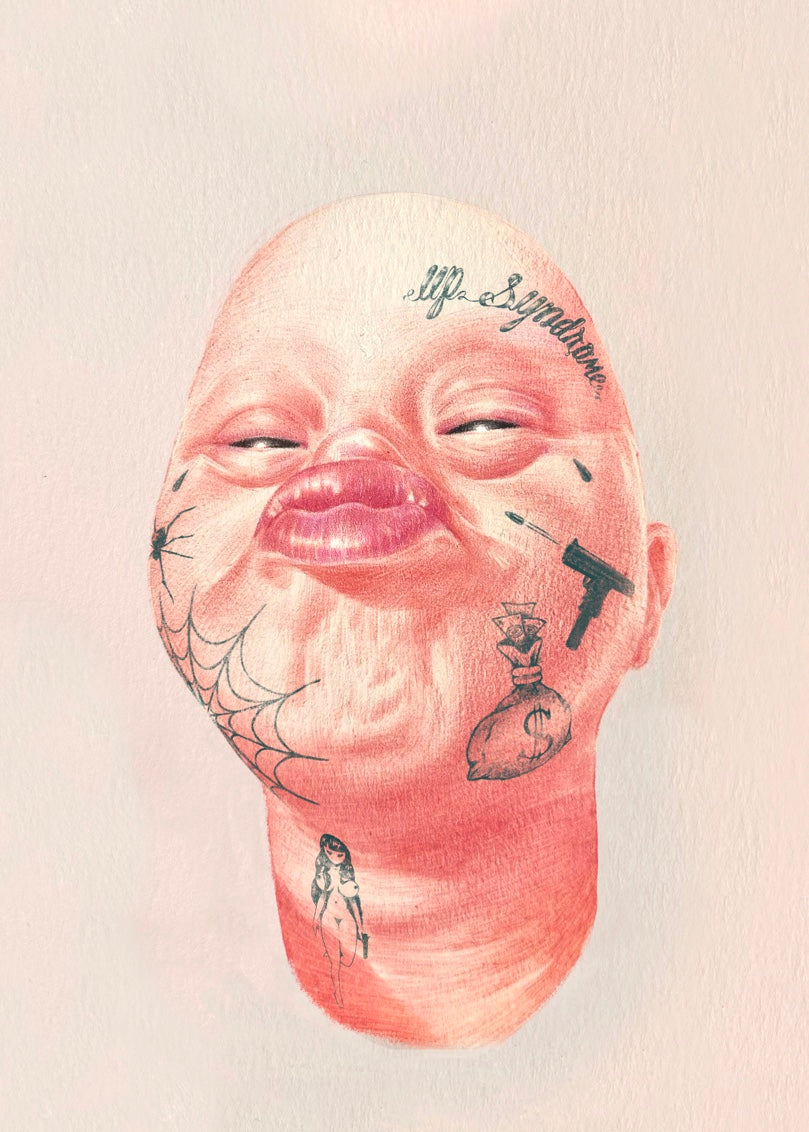 Up Syndrome Print