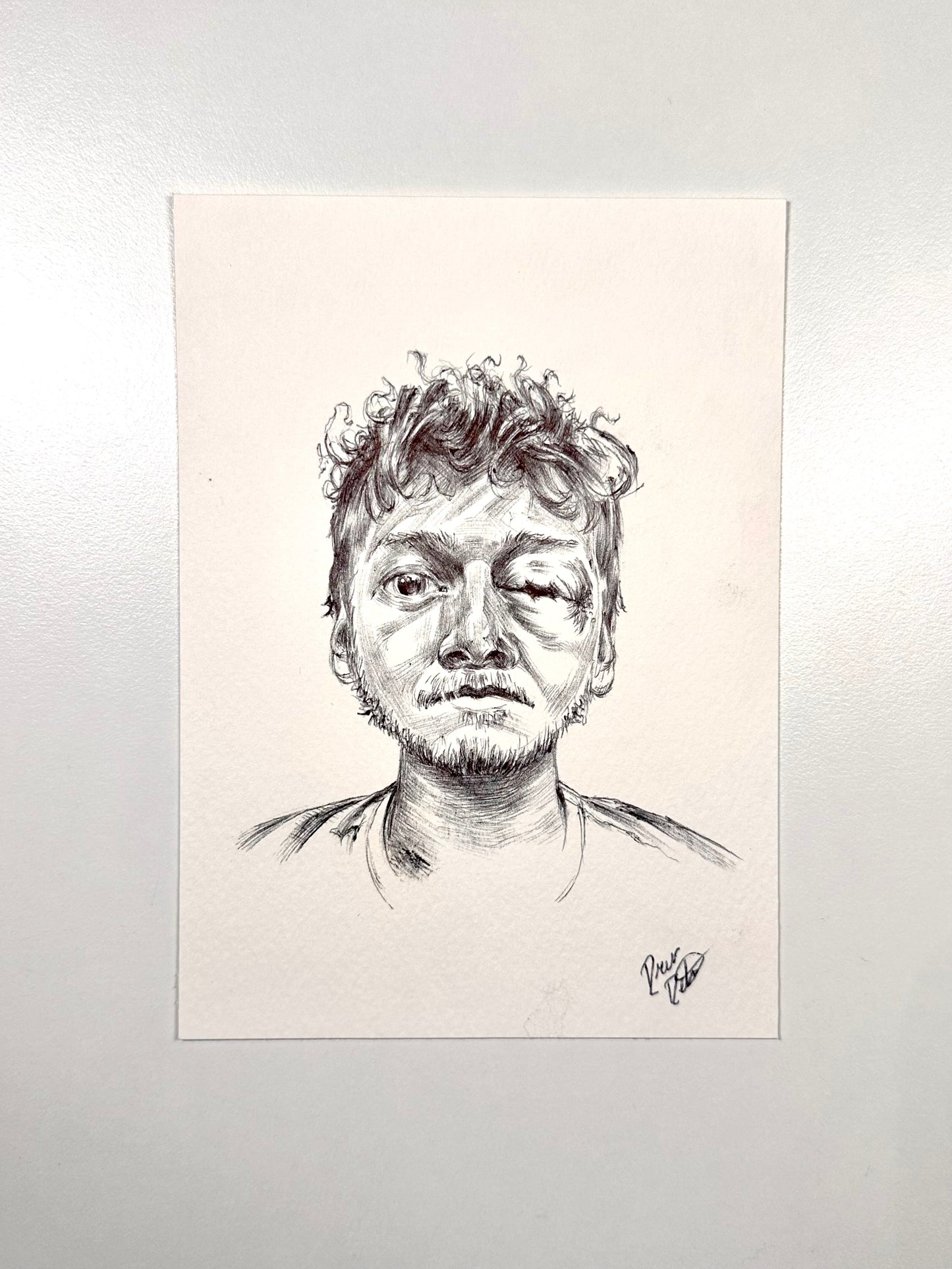 Swollen Eye Guy Art (draw my ex)