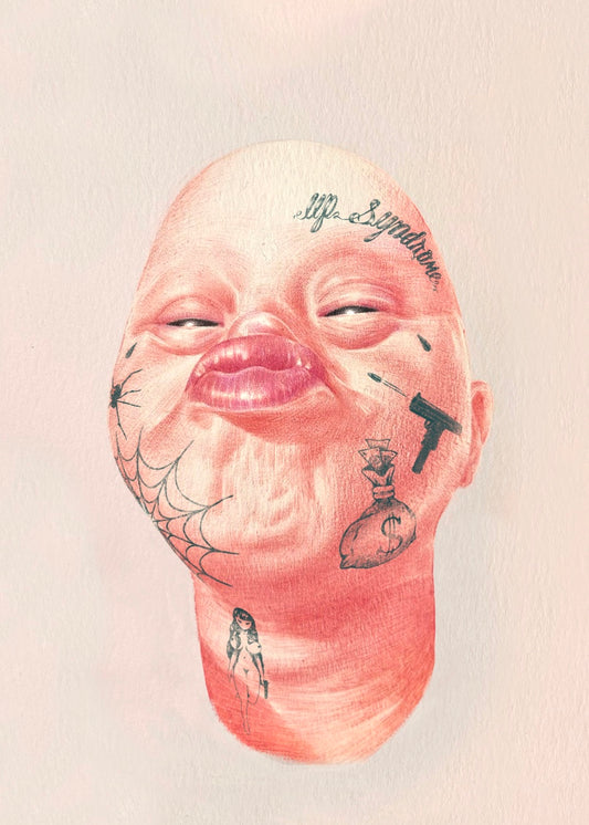 Up Syndrome Print
